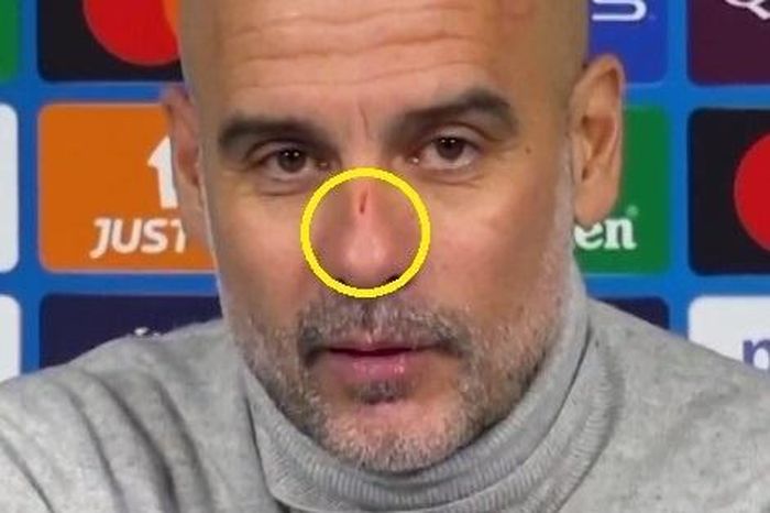 Pep Guardiola tự cào mặt