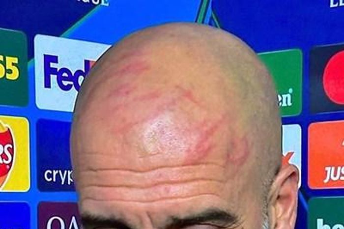 HLV Pep Guardiola tự cào mặt khi Man City hòa cay đắng