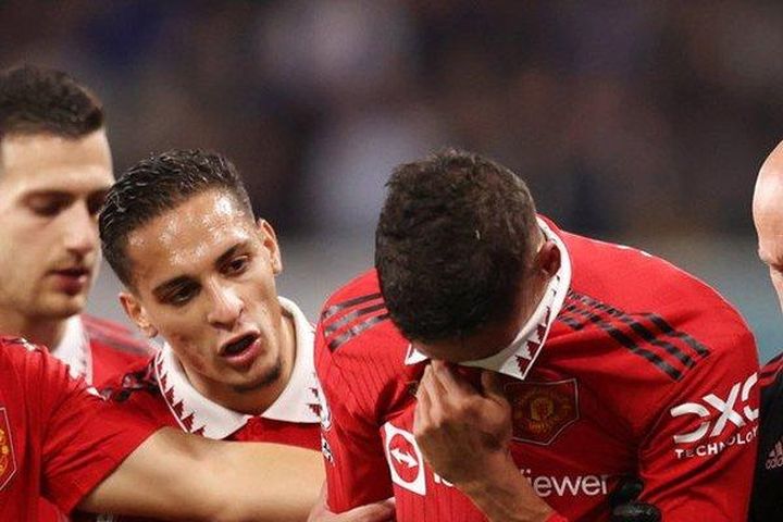 Varane còn cơ hội dự World Cup 2022