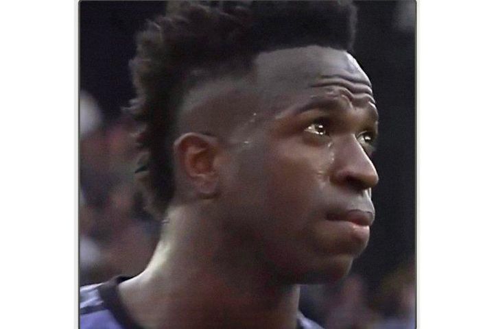 Da của Vinicius màu đen, có gì sai?