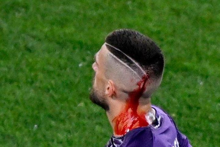 Sao Fiorentina bị CĐV ném chảy máu đầu ở chung kết Conference League
