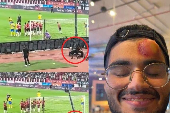 Ronaldo sút phạt khiến cameraman bươu trán